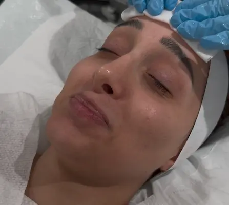 Step 1: Skin preparation for carbon laser peel